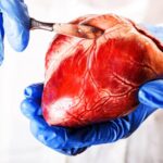 trasplante-de-corazon
