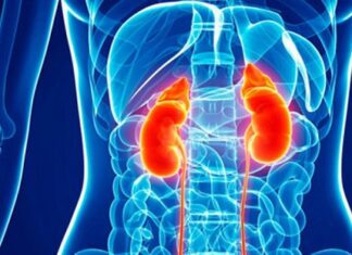 Insuficiencia renal aguda
