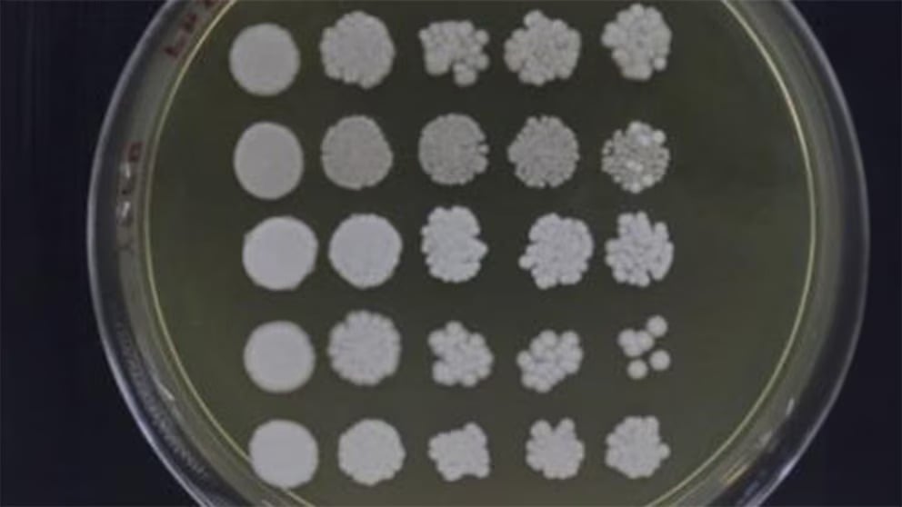 candida parapsilosis