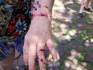 atacada-por-perro-e1761957051742