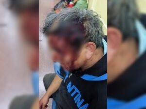 herido-en-la-cabeza